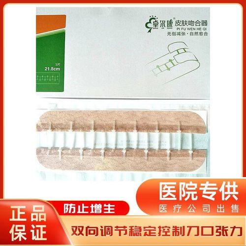 陌駐顏九院減張器皮膚吻合器21.8cm疤痕減張器兒童術(shù)后傷口減張器 21